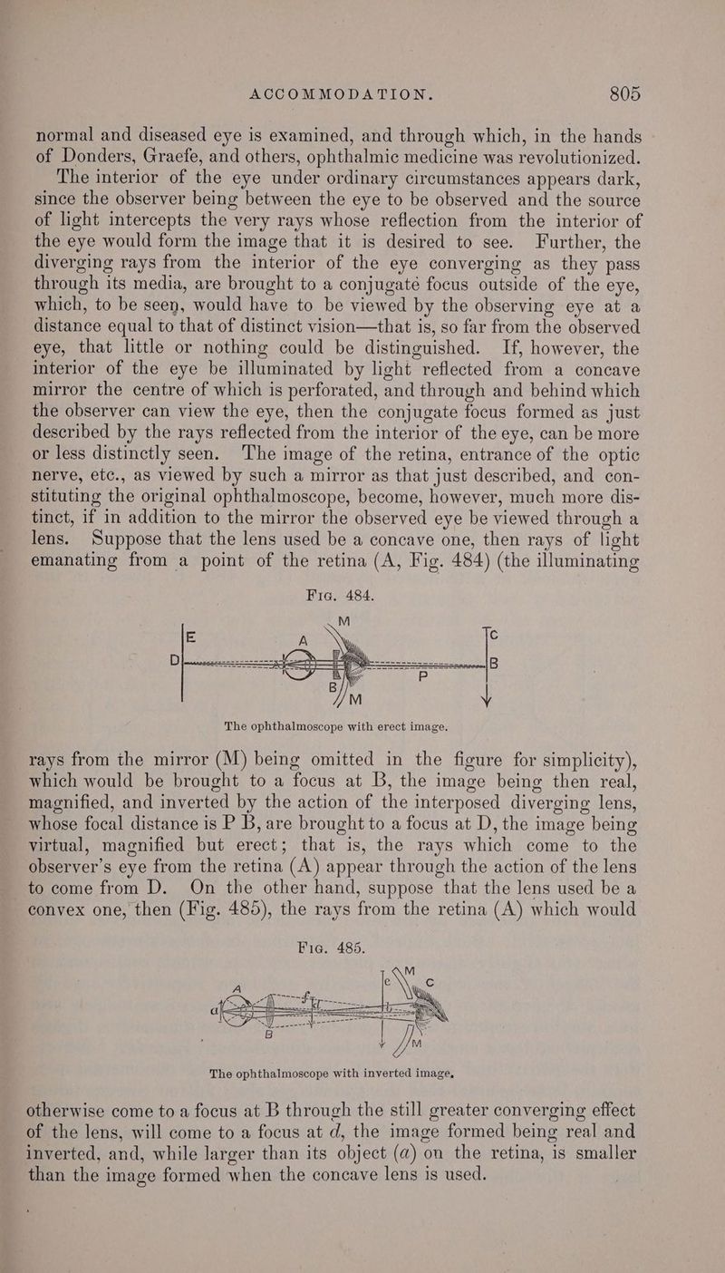 normal and diseased eye is examined, and through which, in the hands of Donders, Graefe, and others, ophthalmic medicine was revolutionized. The interior of the eye under ordinary circumstances appears dark, since the observer being between the eye to be observed and the source of light intercepts the very rays whose reflection from the interior of the eye would form the image that it is desired to see. Further, the diverging rays from the interior of the eye converging as they pass through its media, are brought to a conjugaté focus outside of the eye, which, to be seen, would have to be viewed by the observing eye at a distance equal to that of distinct vision—that is, so far from the observed eye, that little or nothing could be distinguished. If, however, the interior of the eye be illuminated by light reflected from a concave mirror the centre of which is perforated, and through and behind which the observer can view the eye, then the conjugate focus formed as just described by the rays reflected from the interior of the eye, can be more or less distinctly seen. The image of the retina, entrance of the optic nerve, etc., as viewed by such a mirror as that just described, and con- stituting the original ophthalmoscope, become, however, much more dis- tinct, if in addition to the mirror the observed eye be viewed through a lens. Suppose that the lens used be a concave one, then rays of light emanating from a point of the retina (A, Fig. 484) (the illuminating Fig. 484. rays from the mirror (M) being omitted in the figure for simplicity), which would be brought to a focus at B, the image being then real, magnified, and inverted by the action of the interposed diverging lens, whose focal distance is P B, are brought to a focus at D, the image being virtual, magnified but erect; that is, the rays which come to the observer’s eye from the retina (A) appear through the action of the lens to come from D. On the other hand, suppose that the lens used be a convex one, then (Fig. 485), the rays from the retina (A) which would The ophthalmoscope with inverted image, otherwise come to a focus at B through the still greater converging effect of the lens, will come to a focus at d, the image formed being real and inverted, and, while larger than its object (a) on the retina, is smaller than the image formed when the concave lens is used.