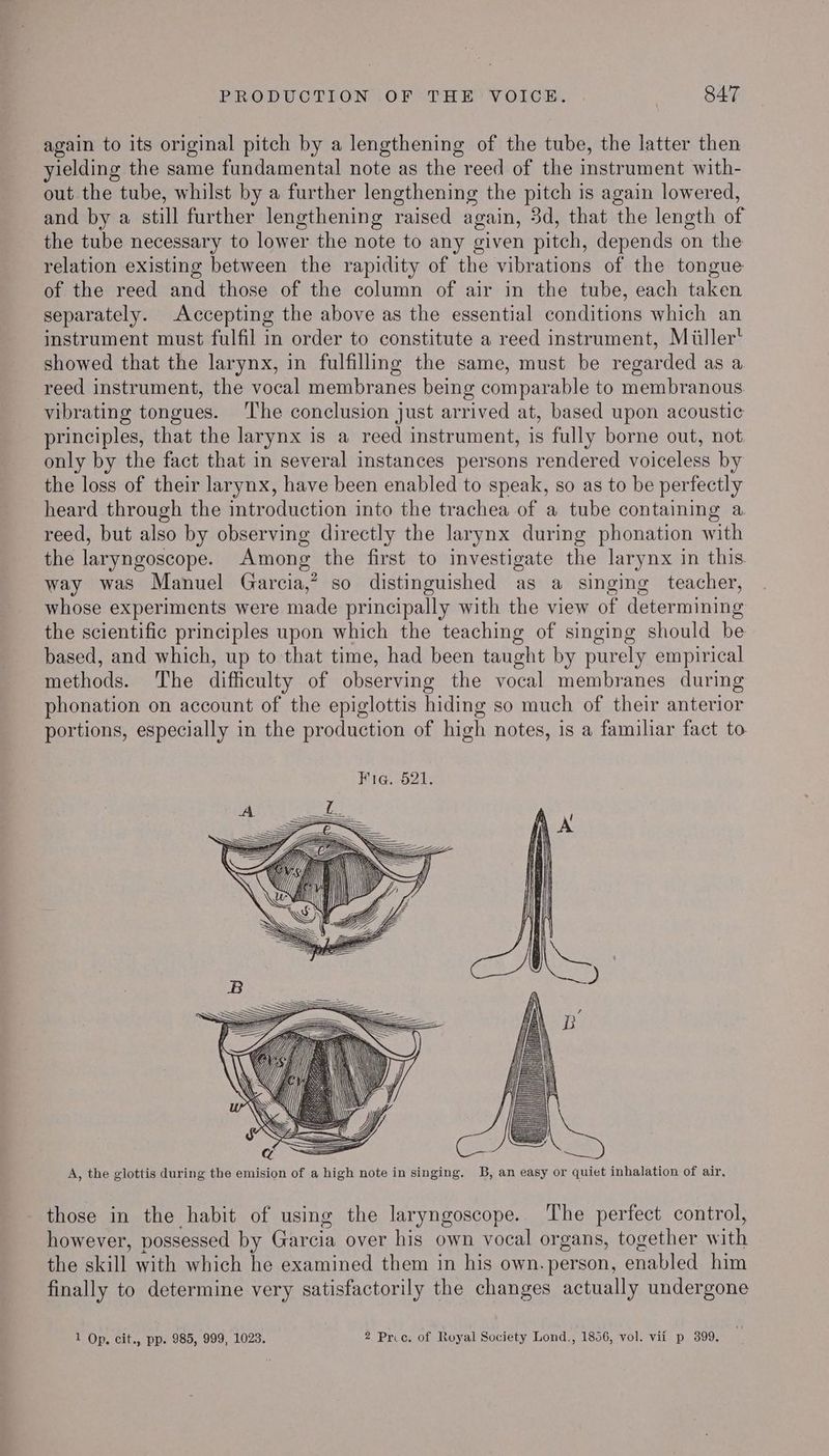 again to its original pitch by a lengthening of the tube, the latter then yielding the same fundamental note as the reed of the instrument with- out the tube, whilst by a further lengthening the pitch is again lowered, and by a still further lengthening raised again, 3d, that the length of the tube necessary to lower the note to any given pitch, depends on the relation existing between the rapidity of the vibrations of the tongue of the reed and those of the column of air in the tube, each taken separately. Accepting the above as the essential conditions which an instrument must fulfil in order to constitute a reed instrument, Miiller' showed that the larynx, in fulfilling the same, must be regarded as a reed instrument, the vocal membranes being comparable to membranous vibrating tongues. ‘The conclusion just arrived at, based upon acoustic principles, that the larynx is a reed instrument, is fully borne out, not only by the fact that in several instances persons rendered voiceless by the loss of their larynx, have been enabled to speak, so as to be perfectly heard through the introduction into the trachea of a tube containing a reed, but also by observing directly the larynx during phonation with the laryngoscope. Among the first to investigate the larynx in this way was Manuel Garcia,” so distinguished as a singing teacher, whose experiments were made principally with the view of determining the scientific principles upon which the teaching of singing should be based, and which, up to that time, had been taught by purely empirical methods. The difficulty of observing the vocal membranes during phonation on account of the epiglottis hiding so much of their anterior portions, especially in the production of high notes, is a familiar fact to A, the glottis during the emision of a high note in singing. B, an easy or quiet inhalation of air, those in the habit of using the laryngoscope. The perfect control, however, possessed by Garcia over his own vocal organs, together with the skill with which he examined them in his own. person, enabled him finally to determine very satisfactorily the changes actually undergone 1 Op, cit., pp. 985, 999, 1023. 2 Price. of Royal Society Lond., 1856, vol. vii p 399.