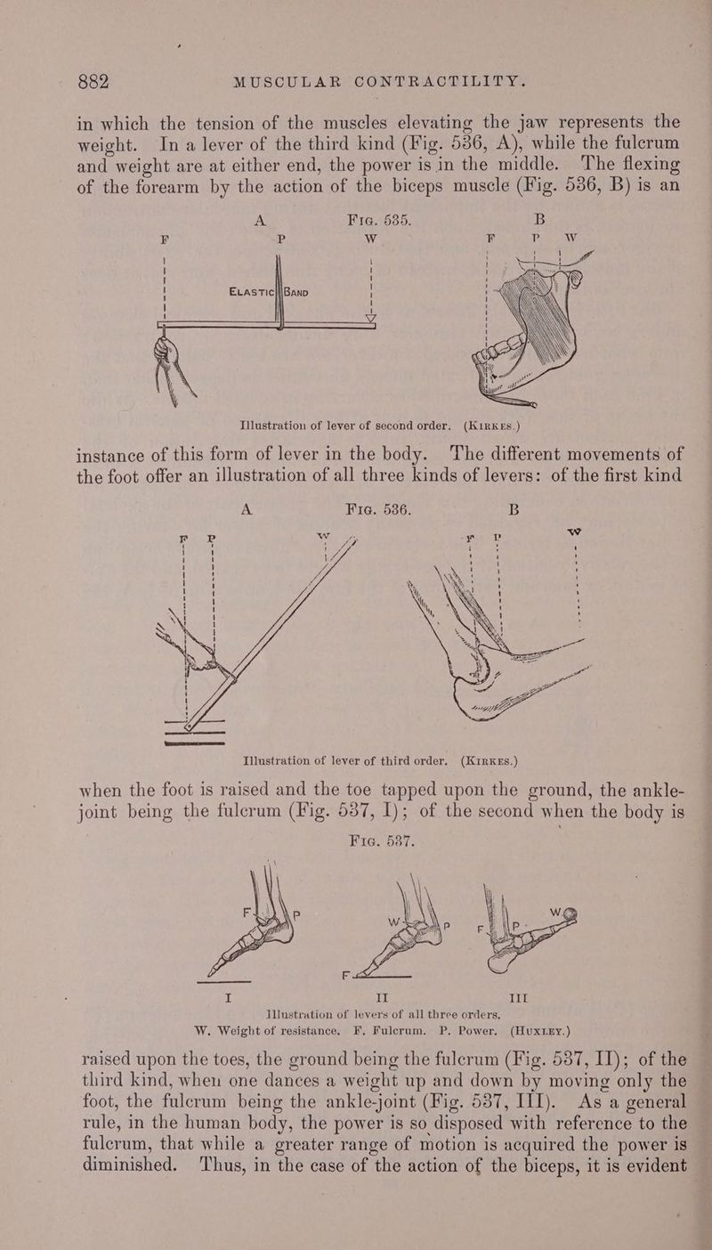 in which the tension of the muscles elevating the jaw represents the weight. Ina lever of the third kind (Fig. 536, A), while the fulcrum and weight are at either end, the power is in the middle. The flexing of the forearm by the action of the biceps muscle (Fig. 536, B) is an A Fira. 535. Ra* Ws F J J ! J 1 | i] RB Illustration of lever of second order. (KIRKES.) instance of this form of lever in the body. The different movements of the foot offer an illustration of all three kinds of levers: of the first kind A Fig. 586. B Illustration of lever of third order. (K1iRKES.) when the foot is raised and the toe tapped upon the ground, the ankle- joint being the fulcrum (Fig. 587, I); of the second when the body is Fie. 537. Jllustration of levers of all three orders. W. Weight of resistance. F. Fulcrum. P. Power. (Hux ey.) raised upon the toes, the ground being the fulcrum (Fig. 587, IT); of the third kind, wheu one dances a weight up and down by moving only the foot, the fulerum being the ankle-joint (Fig. 587, III). As a general rule, in the human body, the power is so disposed with reference to the fulcrum, that while a greater range of motion is acquired the power is diminished. ‘Thus, in the case of the action of the biceps, it is evident