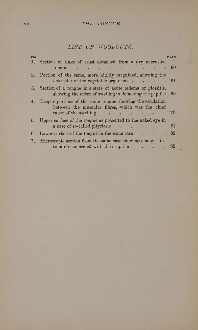 LIST OF WOODCUTS. Section of flake of crust detached from a ay encrusted tongue Portion of the same, more highly sation sire the character of the vegetable organisms . . Section of a tongue in a state of acute cedema or glossitis, showing the effect of swelling in detaching the papillee Deeper portions of the same tongue showing the exudation between the muscular fibres, which was the chief cause of the swelling . : . Upper surface of the tongue as presented to the naked eye in a case of so-called pityriasis ; . : : : Lower surface of the tongue in the same case ‘ timately connected with the eruption . 60 61 69 70 81 82 82