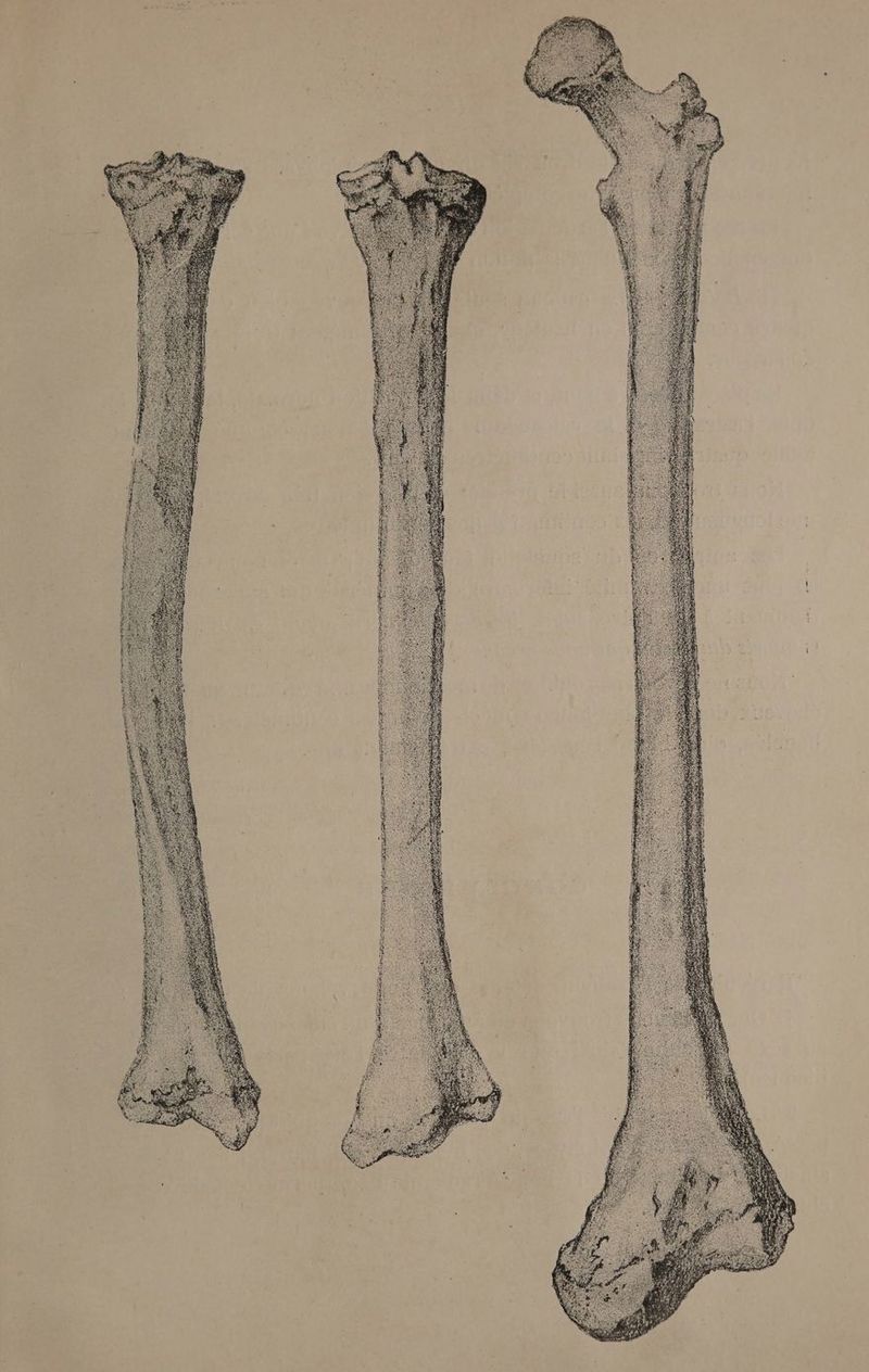 CAE