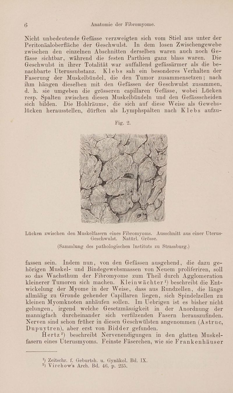 Nicht unbedeutende Gefässe verzweigten sich vom Stiel aus unter der Peritonäaloberfläche der Geschwulst. In dem losen Zwischengewebe zwischen den einzelnen Abschnitten derselben waren auch noch Ge- fässe sichtbar, während die festen Parthien ganz blass waren. Die Geschwulst in ihrer Totalität war auffallend gefässärmer als die be- nachbarte Uterussubstanz. Klebs sah ein besonderes Verhalten der Faserung der Muskelbündel, die den Tumor zusammensetzen; nach ihm hängen dieselben mit den Gefässen der Geschwulst zusammen, d. h. sie umgeben die grösseren capillaren Gefässe, wobei Lücken resp. Spalten zwischen diesen Muskelbündeln und den Gefässscheiden sich bilden. Die Hohlräume, die sich auf diese Weise als Gewebs- lücken herausstellen, dürften als Lymphspälten nach Klebs aufzu- Aal Ä f | INH I AN /) H , NEN I Lücken zwischen den Muskelfasern eines Fibromyoms. Ausschnitt aus einer Uterus- Geschwulst. Natürl. Grösse. (Sammlung des pathologischen Instituts zu Strassburg.) fassen sein. Indem nun, von den Gefässen ausgehend, die dazu ge- hörigen Muskel- und Bindegewebsmassen von Neuem proliferiren, soll so das Wachsthum der Fibromyome zum Theil durch Asglomeration kleinerer Tumoren sich machen. Kleinwächter?!) beschreibt die Ent- ‚wickelung der Myome in der Weise, dass aus Rundzellen, die längs allmälig zu Grunde gehender Capillaren liegen, sich Spindelzellen zu kleinen Myomknoten anhäufen sollen. Im Uebrigen ist es bisher nicht gelungen, irgend welche Gesetzmässigkeit in der Anordnung der mannigfach durcheinander sich verfilzenden Fasern herauszufinden. Nerven sind schon früher in diesen Geschwülsten angenommen (Astruc, Dupuytren), aber erst von Bidder gefunden. Hertz?) beschreibt Nervenendigungen in den glatten Muskel- fasern eines Üterusmyoms. Feinste Fäserchen, wie sie Frankenhäuser !) Zeitschr. f. Geburtsh. u. Gynäkol. Bd. IX. ?\ Virchow’s Arch. Bd. 46,:p. 235.