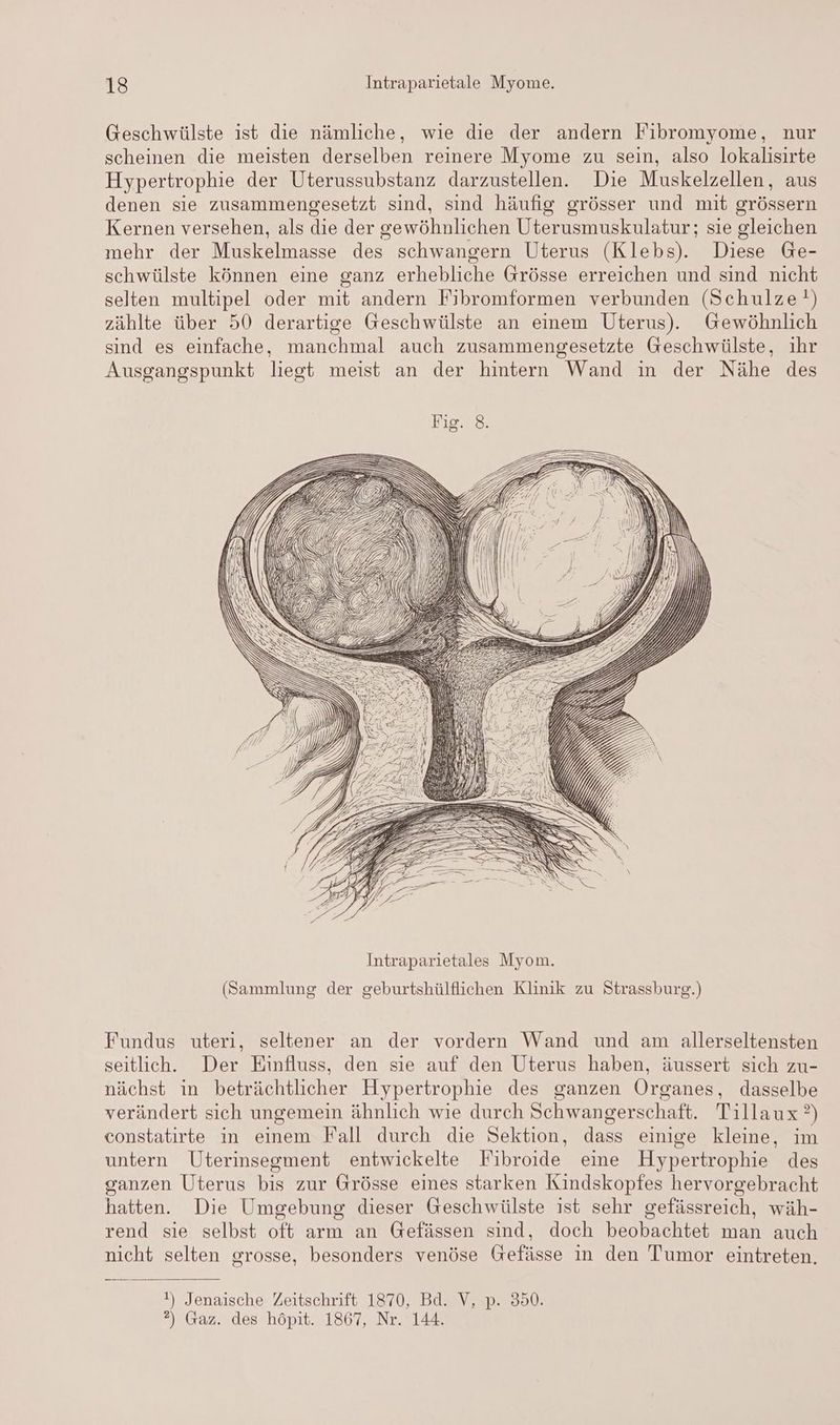 Geschwülste ist die nämliche, wie die der andern Fibromyome, nur scheinen die meisten derselben reinere Myome zu sein, also lokalisirte Hypertrophie der Uterussubstanz darzustellen. Die Muskelzellen, aus denen sie zusammengesetzt sind, sind häufig grösser und mit grössern Kernen versehen, als die der gewöhnlichen Uterusmuskulatur; sie gleichen mehr der Muskelmasse des schwangern Uterus (Klebs). Diese Ge- schwülste können eine ganz erhebliche Grösse erreichen und sind nicht selten multipel oder mit andern Fibromformen verbunden (Schulze!) zählte über 50 derartige Geschwülste an einem Uterus). Gewöhnlich sind es einfache, manchmal auch zusammengesetzte Geschwülste, ihr Ausgangspunkt liegt meist an der hintern Wand in der Nähe des Intraparietales Myom. (Sammlung der geburtshülflichen Klinik zu Strassburg.) Fundus uteri, seltener an der vordern Wand und am allerseltensten seitlich. Der Einfluss, den sie auf den Uterus haben, äussert sich zu- nächst in beträchtlicher Hypertrophie des ganzen Organes, dasselbe verändert sich ungemein ähnlich wie durch Schwangerschaft. Tillaux ?) constatirte in einem Fall durch die Sektion, dass einige kleine, im untern Uterinsegment entwickelte Fibroide eine Hypertrophie des ganzen Uterus bis zur Grösse eines starken Kindskopfes hervorgebracht hatten. Die Umgebung dieser Geschwülste ist sehr gefässreich, wäh- rend sie selbst oft arm an Gefässen sind, doch beobachtet man auch nicht selten grosse, besonders venöse Gefässe in den Tumor eintreten. !) Jenaische Zeitschrift 1870, Bd. V, p. 350. ?) Gaz. des höpit. 1867, Nr. 144.