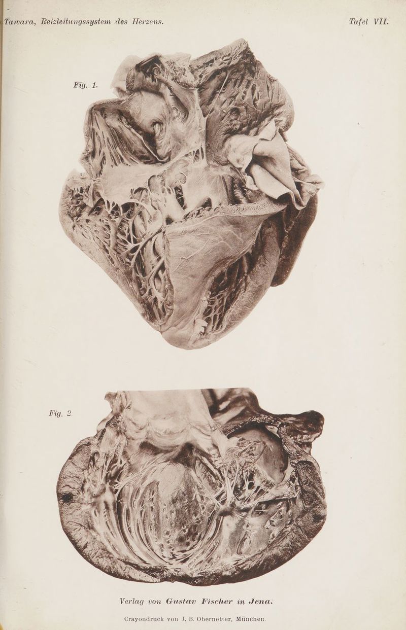 - Tawara, Reizleitungssystem des Herzens. Tafel VII.