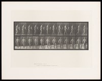 view A naked man with hemiplegia walking with a stick: (above) from the side, (below) from the front. Collotype after Eadweard Muybridge, 1887.