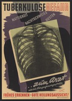 view A radiograph of the chest; representing the need for early detection of pulmonary tuberculosis. Colour lithograph by G.C. Schulz, ca. 1947.