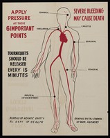 view Points in arteries where pressure reduces bleeding. Colour lithograph by Rhode Island Council of War Agencies, 194-.