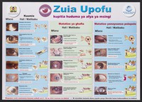 view Eye conditions and treatments: preventing blindness in Kenya through primary health care. Colour lithograph by Ministry of Health, ca. 2000.