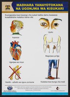 view Diabetes complications in Kenya. Colour lithograph by Ministry of Health, ca. 2000.