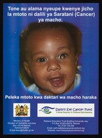 view A baby with eye cancer: the daisy eye cancer fund in Kenya. Colour lithograph by the Ministry of Health and Rattansi Education Trust, ca. 2000.