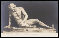 view A dying gladiator. Photograpic postcard, 191-.