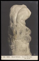 view The Belvedere torso. Photographic postcard, 191-.