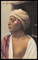 view Photograph of an Arab boy in profile, North Africa.