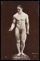 view A nude man posing as a classical statue. Photograph by Henry, 192-.