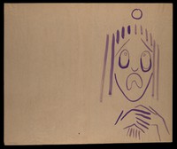 view A purple face in distress. Watercolour by M. Bishop, 1977.