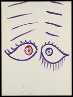 view Two eyes, with purple parallel lines. Watercolour by M. Bishop, 1970.