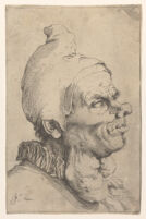 view The head of a man with goitre. Etching by Jusepe de Ribera, 1622.