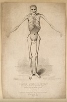 view Claude Ambroise Seurat, known as the 'Human skeleton'. Stipple engraving by R. Cruikshank, 1825.