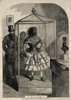 view Julia Pastrana, a bearded woman, embalmed. Wood engraving, 1862.