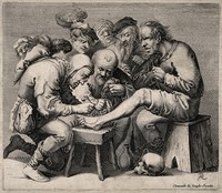 view An operator treating a patient's foot; a crowd of people is gathered around watching the work. Line engraving by P. Quast.