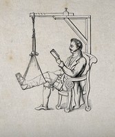 view A man sitting in a chair reading while his leg is in traction and attached to a pulley mechanism. Wood engraving.