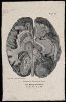 view The brain seen from the underside, sectioned horizontally; with attention to the part associated by Hollander's system of phrenology with memory for numbers. Process print, 1901, after etching, 1809.