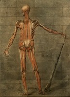 view The muscles of the human body, third layer, seen from the back; the figure balances a club with his right hand and stands before a wall of stone blocks. Colour mezzotint by L. Gautier d'Agoty after A. E. Gautier d'Agoty, 1773.