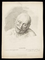 view An écorché face showing the movements of facial muscles during laughter. Stipple engraving by G.T. Stubbs after G. Stubbs, 1800.