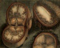 view The brain: three dissections. Colour mezzotint by J.F. Gautier d'Agoty, 1748.