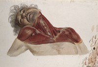 view Partially dissected head, shoulders, chest and neck of a man, showing the deltoid and pectoralis muscles. Watercolour by J.C. Zeller, ca. 1833.