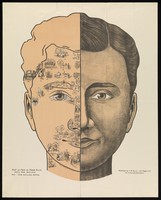 view Phrenological chart; with design of head containing 4 illustrations showing activity of brain. Colour lithograph.