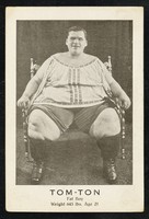 view Tom-Ton : fat boy : weight 645 lbs. age 21.