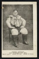 view Johnny Trunley : the Peckham Fat Boy : age 15 years. Height 5ft. 8in. Weight 36 stone.