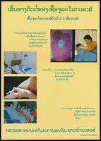 view Numbered images and text including 2 images of a couple making love, a woman lying attached to a drip receiving a blood transfusion, a syringe injecting into an arm and a group of pregnant women; an advertisement from Laos about safe sex and AIDS prevention and the dangers of intravenous drug abuse and pregnancy. Colour lithograph, ca. 1996.