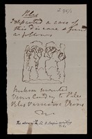 view Memoranda collected by Longmore while helping Bransby Cooper to write life of Sir Astley Cooper. Includes account by Daniel Gosset, who acted as dresser, of operation tying the aorta for aneurism