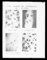 view Microscope image referenced as "Effect of ultrasonics upon mitosis sticky chromosome bridges"