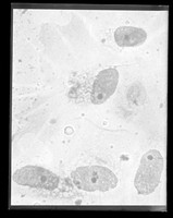 view Microscope image referenced as "Autoradiograph 28 day exposure"