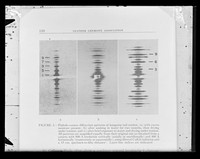 view Copy of printed x-ray diffraction exposures referenced as "Pinhole camera diffraction patterns of kangaroo tail tendon"