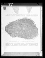 view Copy of a printed microscope image referenced as "T.S. L.P. Human muscle Max and Bloon"