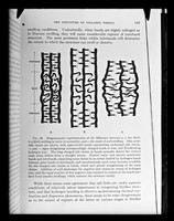 view Copy of a printed diagram referenced as "Diagram showing difference between a dry, fibril, fibril in H2O and acid swelling"