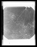 view Microscope image referenced as "Collagen and strychnine ppt [parts per trillion]"