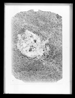 view Microscope image referenced as "Section of 14 day tibia head. 1st batch spec[imen] 3. Various cells and deteriorated"