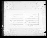 view Histogram referenced as "Standard rod and tilted rod transform I.IV.56"