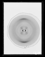 view X-ray diffraction exposure of DNA and histone sample referenced as "Lysine rich histone + DNA 98% RH [relative humidity]"