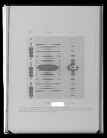 view Copy of a printed photographic image referenced as "Optical and x-ray diffractions patterns of DNA"