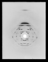 view X-ray diffraction exposure of B-type DNA referenced as "B pattern 20th layer line"