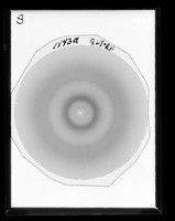 view X-ray diffraction exposure referenced as "Histone diffraction B"