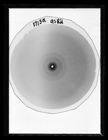 view X-ray diffraction exposure of RNA referenced as "Film 1713 RNA"