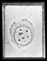 view Electron microscope image referenced as "Haemanthus-interface"