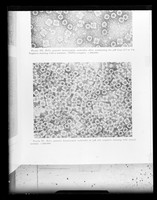 view Copy of a printed electron microscope image referenced as "Protein molecules E.M photograph"